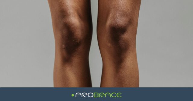 Meniscus Kniebrace Schade Trauma Ondersteuning Probrace Brace