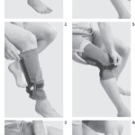 Medi Genumedi® Pss Kniebrace Knieorthese Voor De Patellapees Aantrek Instructies
