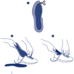 Thuasne Sprystep® Footplate Inlegzool Voorvoetklachten Op Maat Maken