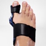 Hallux Valgus Teenbrace Valguloc 2
