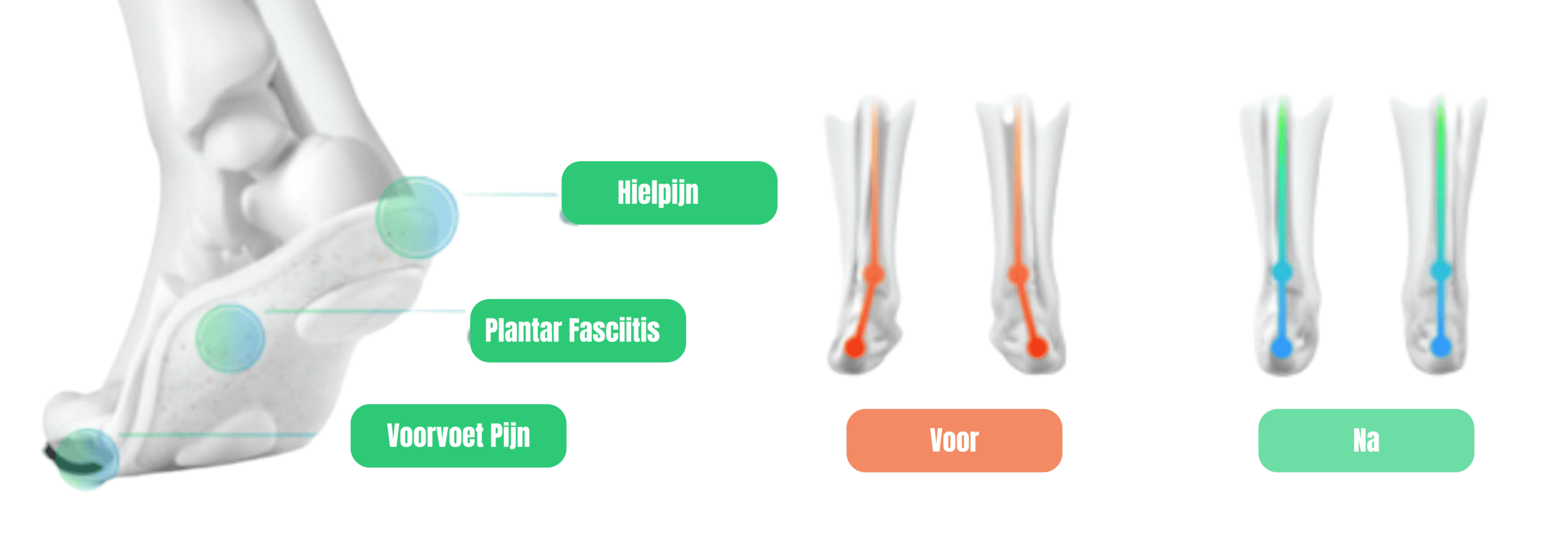 Fitpace Ecodasher Steunzool Voor En Na