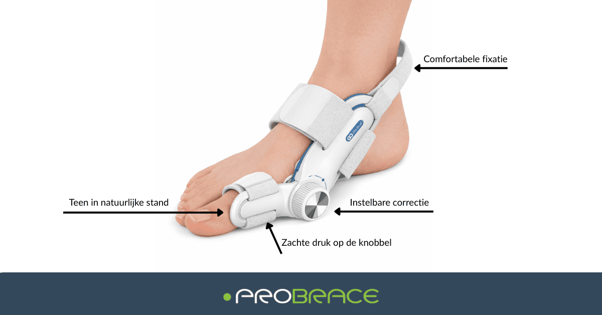Go Medical Hallux Valgus Corrector – Gerichte Ondersteuning Voor De Grote Teen