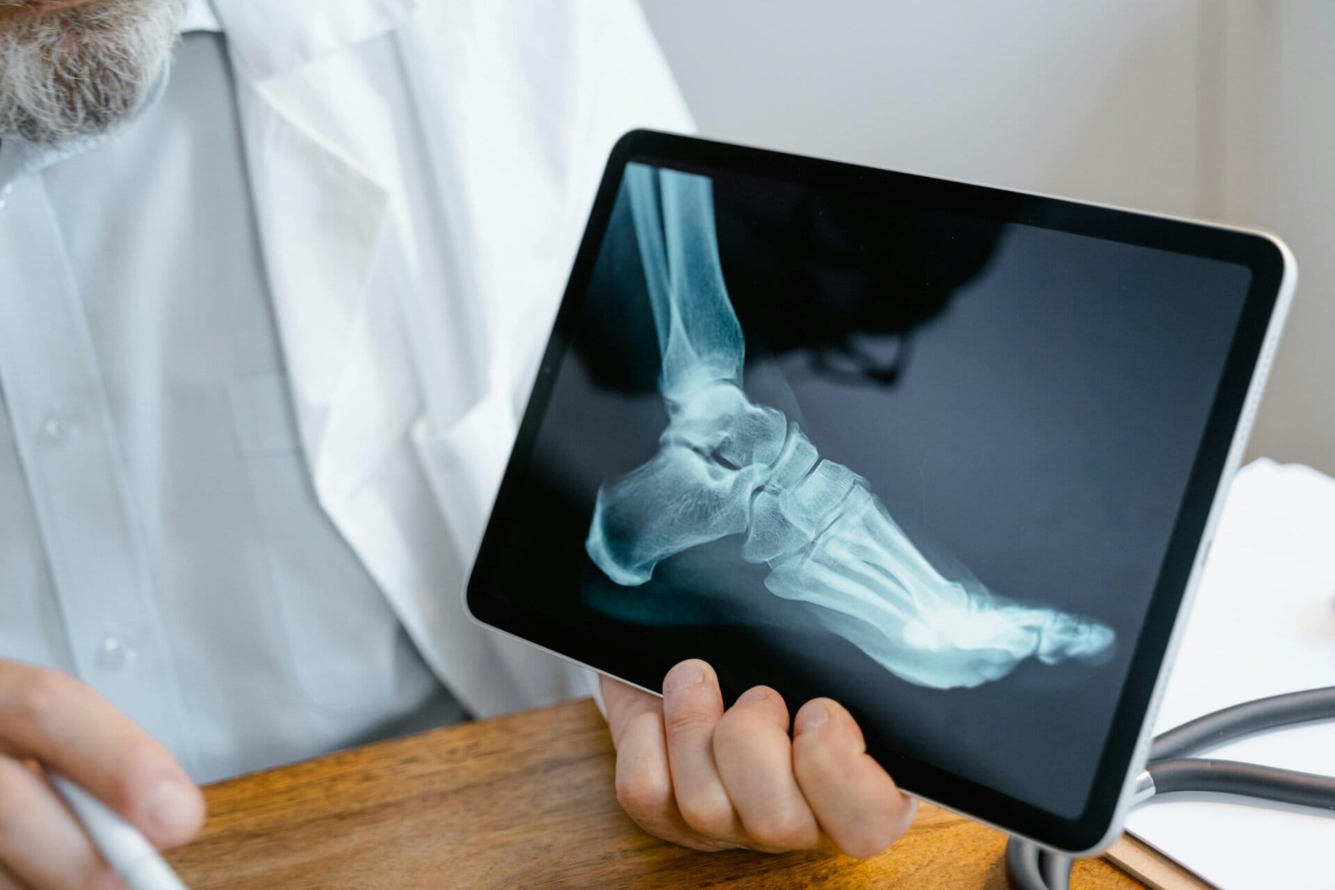 Enkel Blog Instabiliteit Probrace Brace Blessure Enkel Ondersteuning